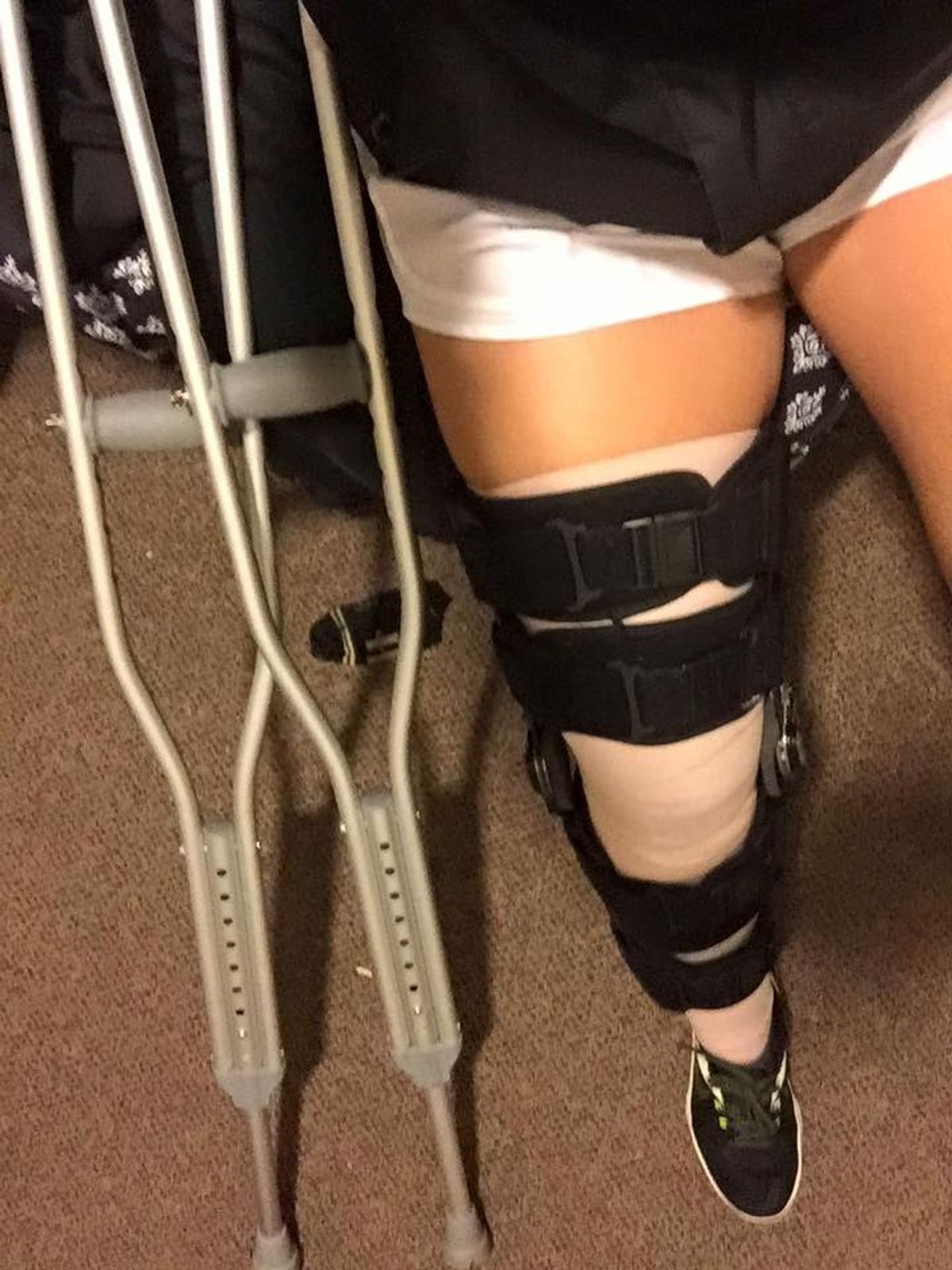 10 Things That Happen When You Tear Your ACL