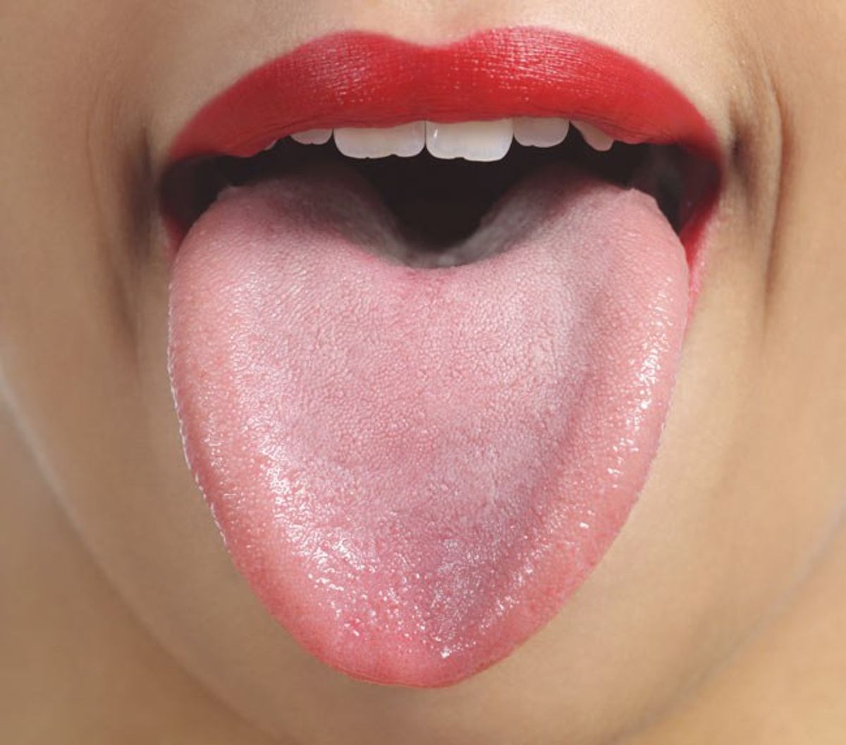 Living With Geographic Tongue