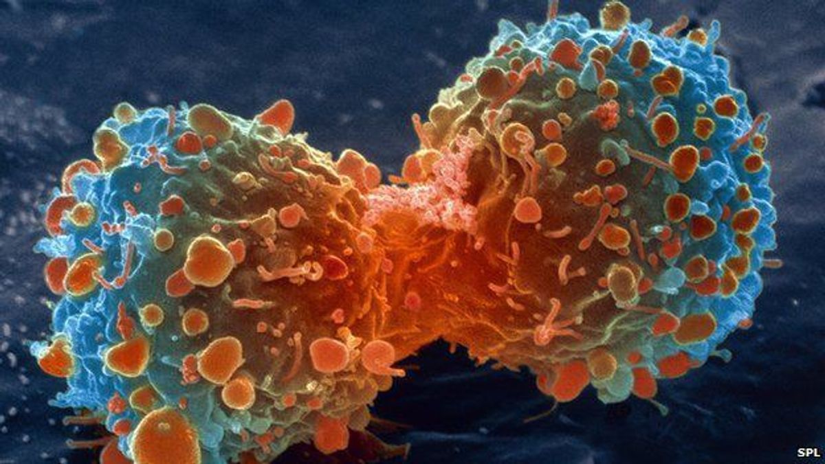 Why There Will Never Be A "Cure For Cancer"