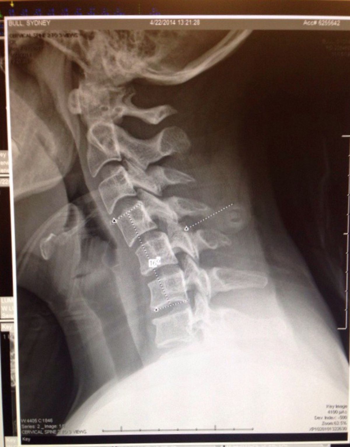 Tinder Date Gone Wrong