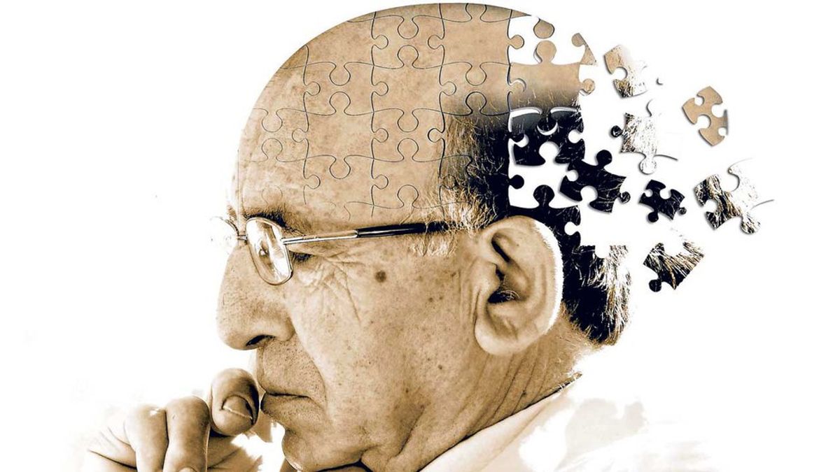 A Scientific Glimpse Into Alzheimer's Disease