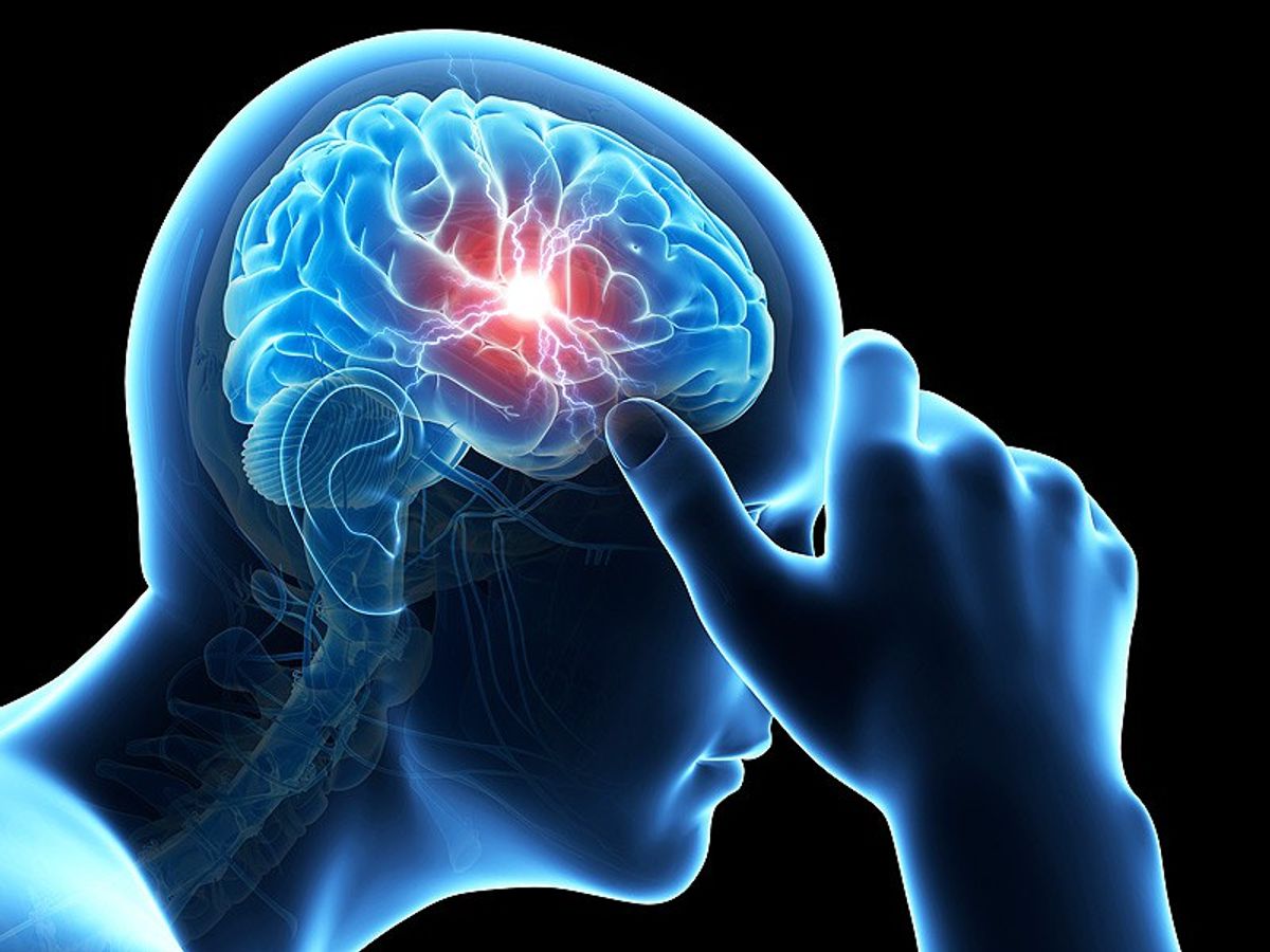 Migraine: Why It Is More Than Just A "Bad Headache"
