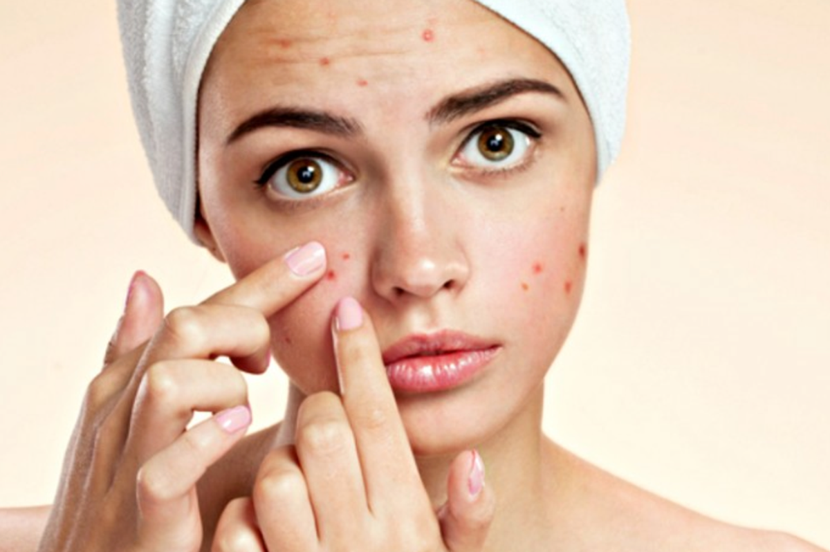 Isotretinoin: Killing Acne And Your Happiness