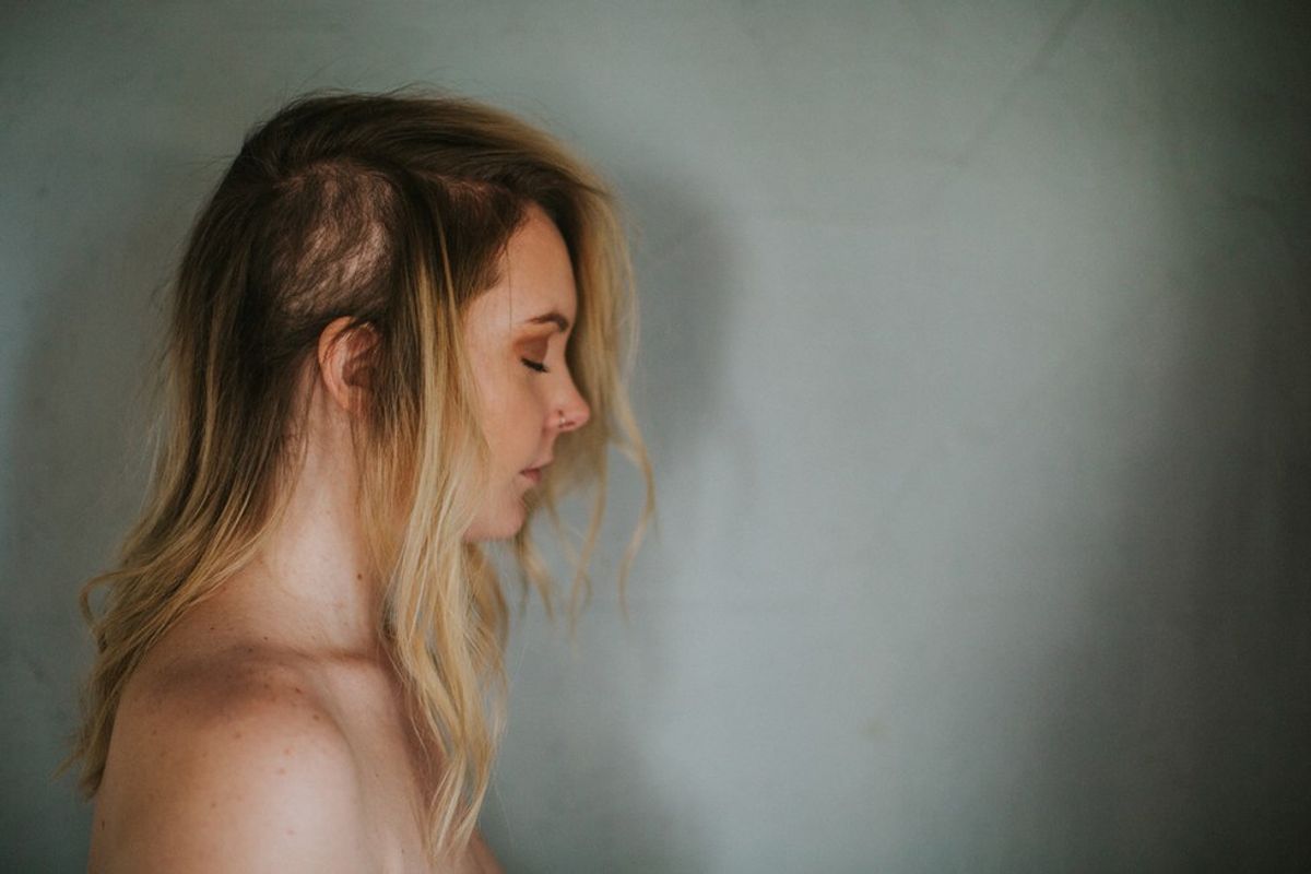 4 Things You Never Knew About Trichotillomania
