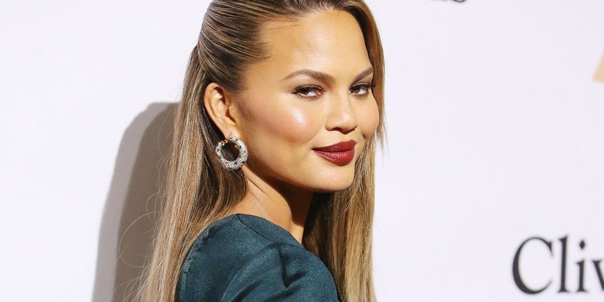 Why Chrissy Teigen's Stretch Mark Photo Matters to Me