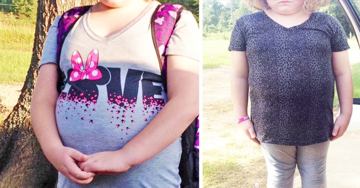 At How Young Do Girls Began to Experience Body Shaming
