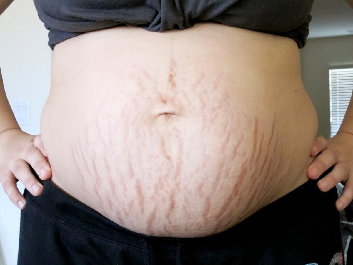 Post Baby Belly and Society Stigma