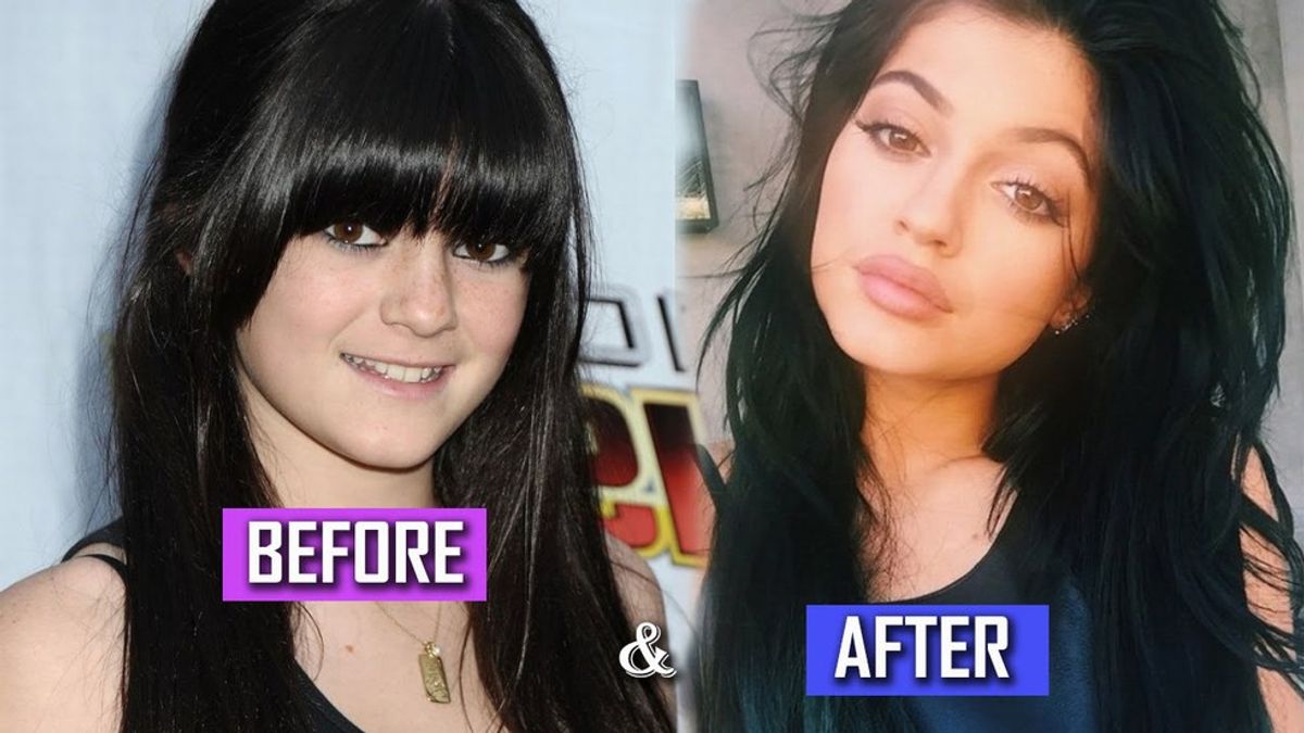 A Letter To Kylie Jenner (And Her Look-A-Likes)