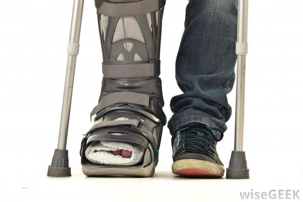 10 Struggles of Having A Broken Foot