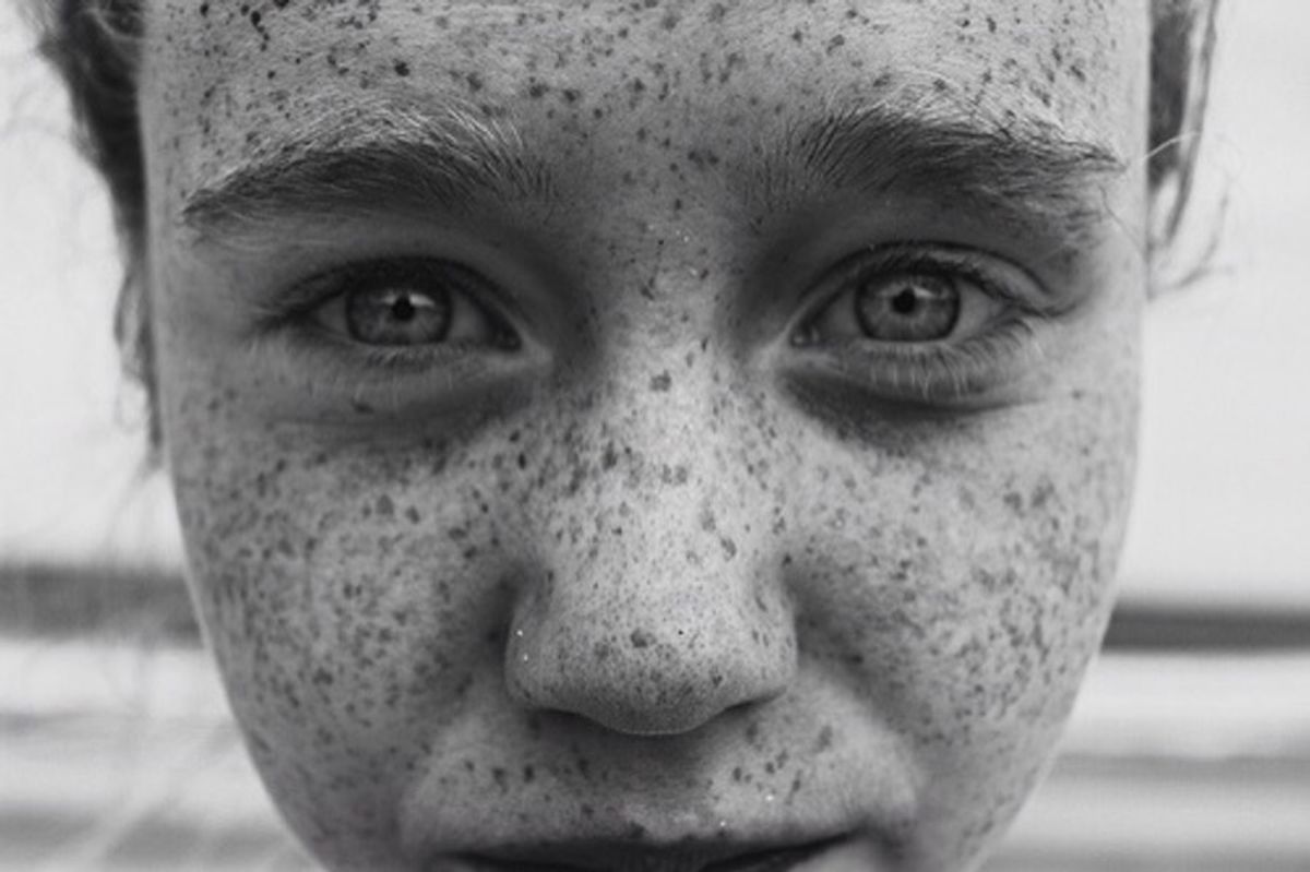 The Fear of Freckles and Other Evidences That Humans Are Not All the Same
