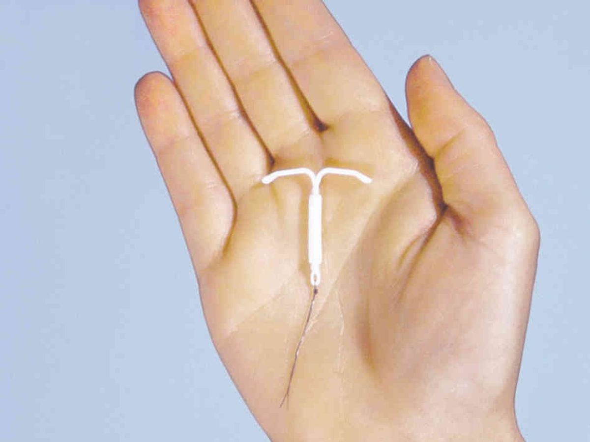 My Painful Experience Using An IUD