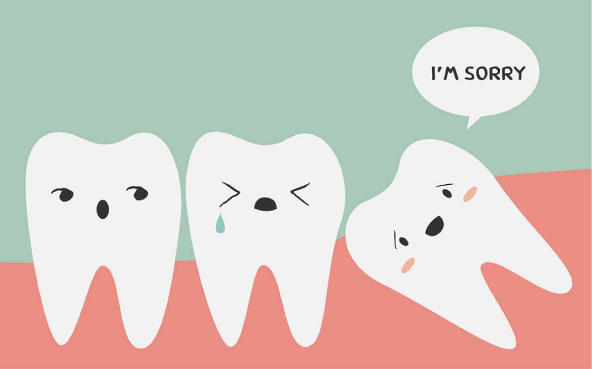 My Wisdom Teeth Experience