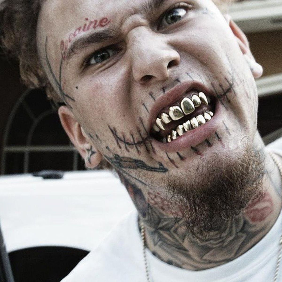 Stitches And What He's Up To These Days.