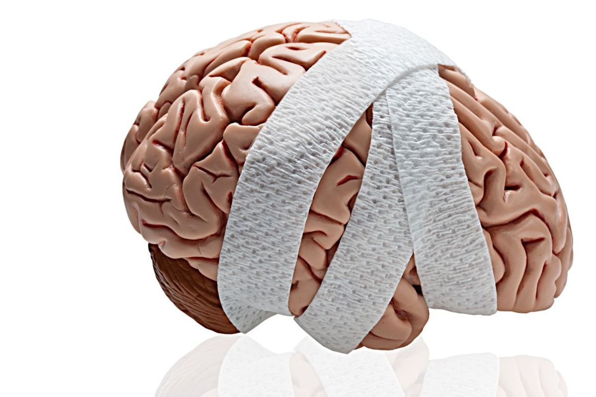 7 Things To Do When You Have A Concussion