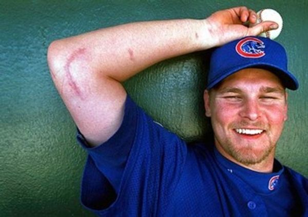 The Truth Behind Tommy John Surgery