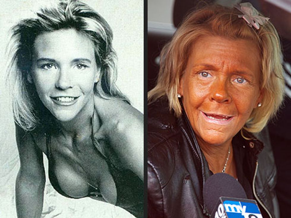 10 Reasons to Seriously Stop Tanning in Tanning Beds