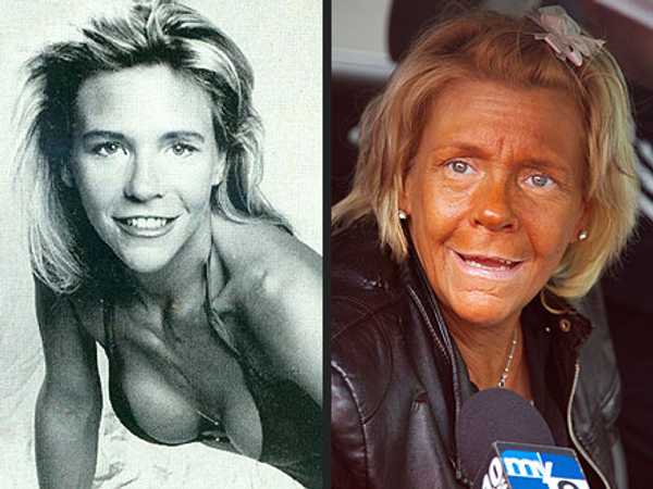 10 Reasons to Seriously Stop Tanning in Tanning Beds