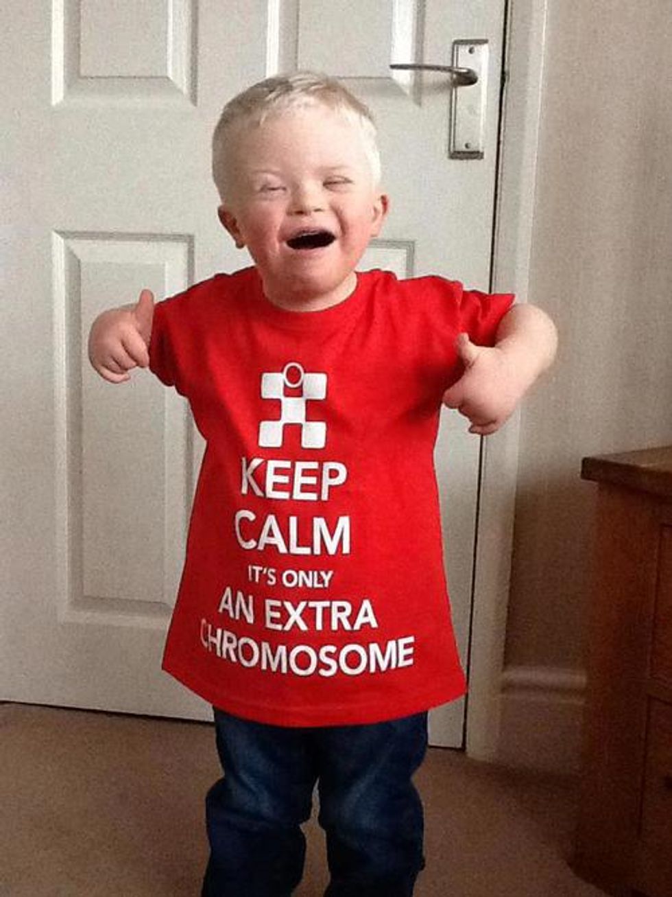 4 Things We Can Learn From People With An Extra Chromosome