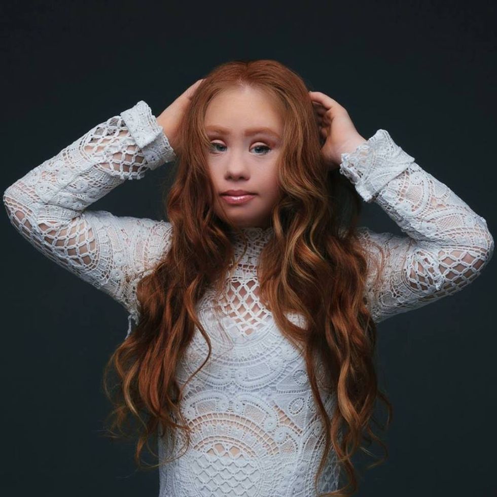 Model With Down Syndrome Makes Groundbreaking Changes At NYFW