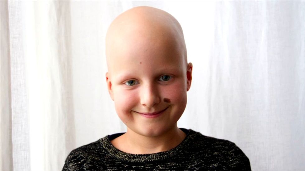 My Alopecia Was A Blessing In Disguise