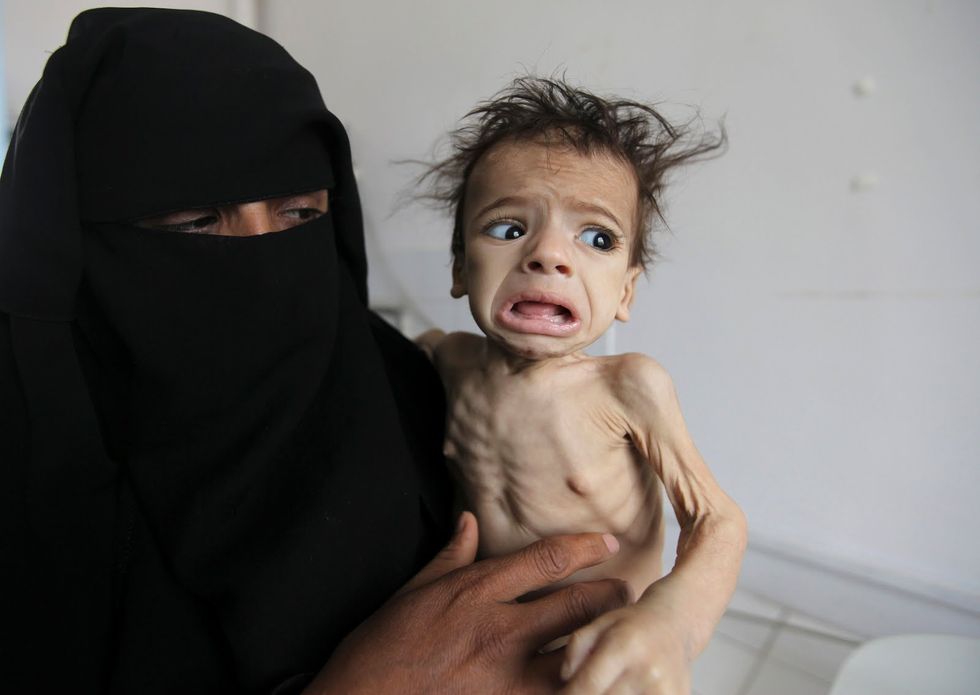 Yemen's Slow Starvation
