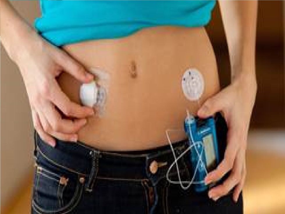 Living With Diabetes