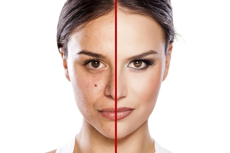 Why No Body Shaming or Beauty Standard Will Define My Beauty