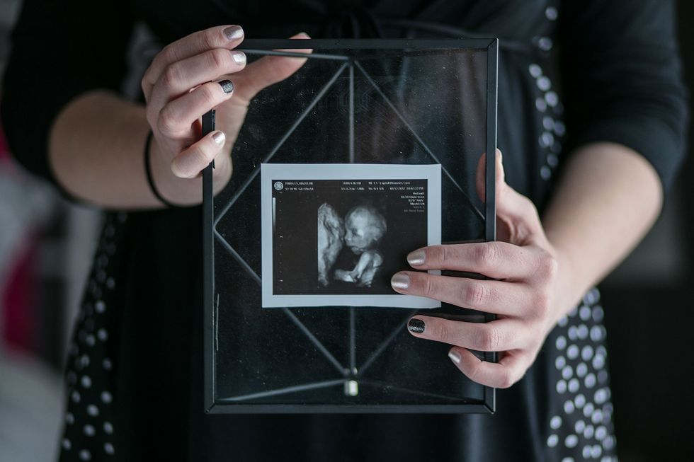 Maddi Runkles And The Pro-Life Movement