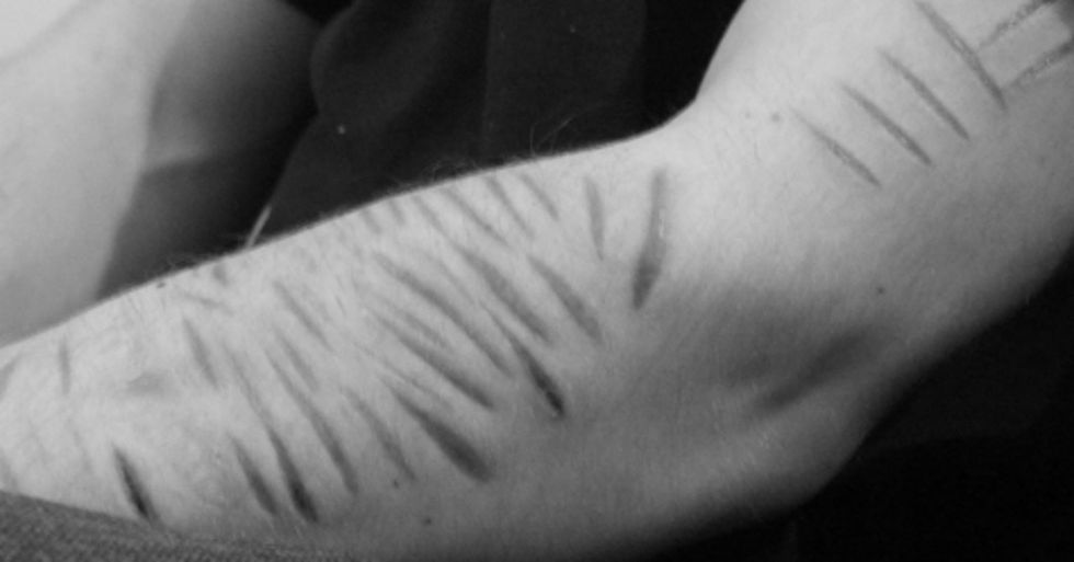 Poetry On Odyssey: Yes, Cutting Is An Addiction