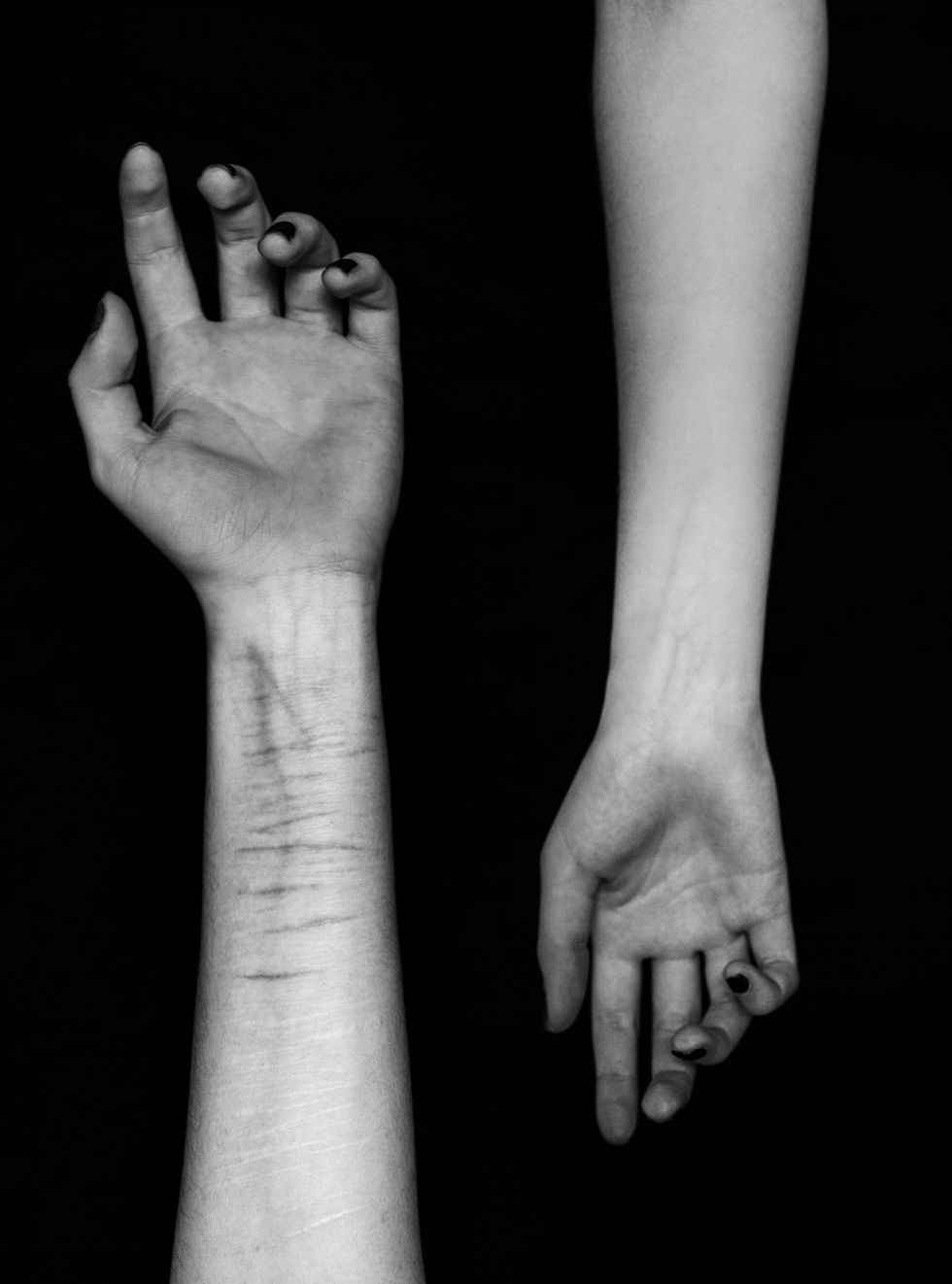 There's Got To Be A Story Behind The Scars