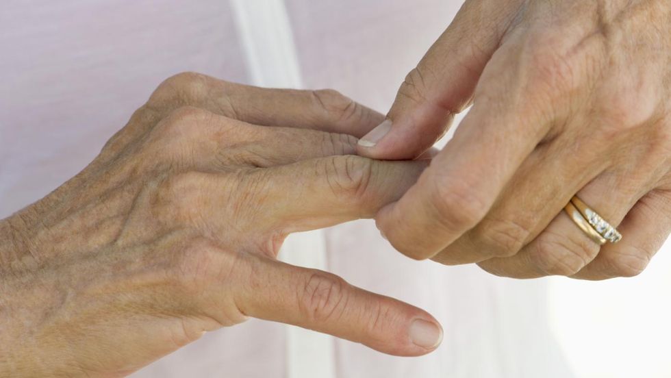 10 Eye-Opening Facts About Arthritis That Prove Why Research Is Important