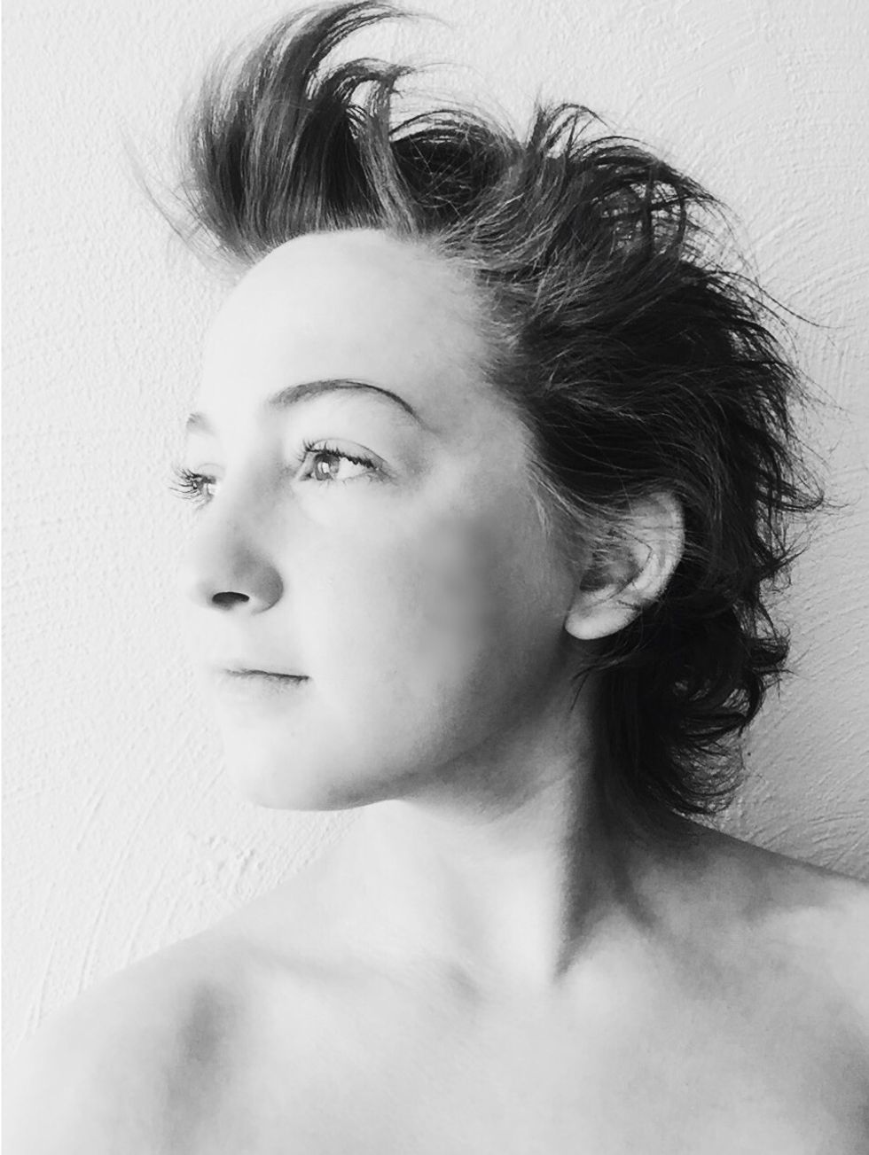 What It's Like To Lose Your Hair At Age 18