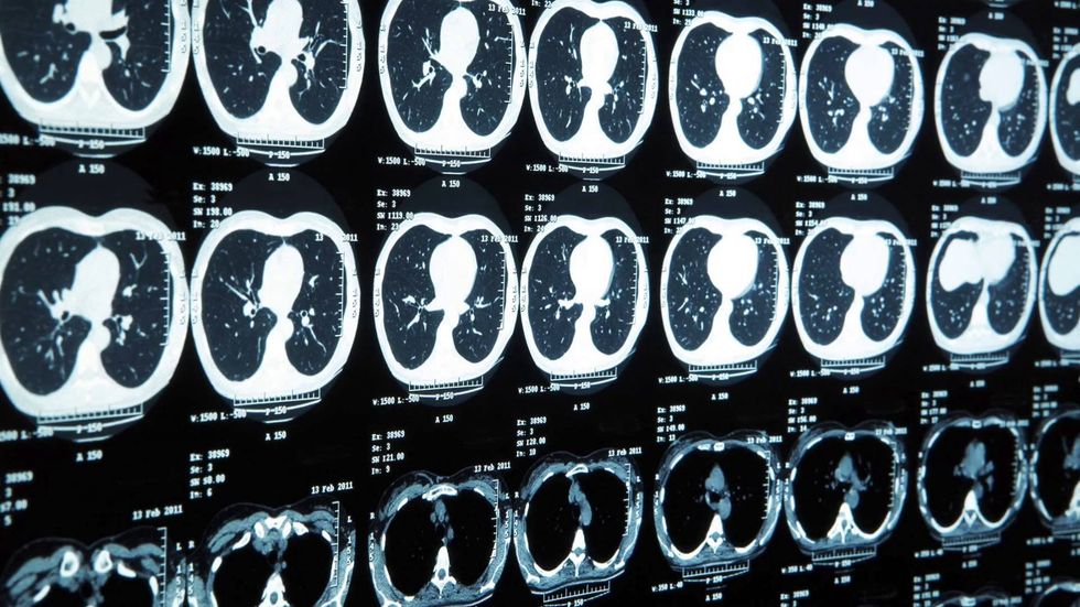 Biomedical Engineering: The Future Of Medicine