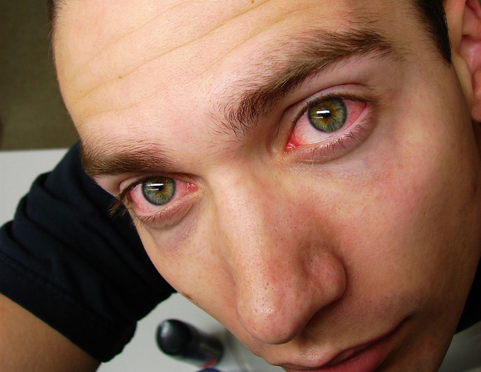 I Didn't Sleep For 5 Days And Mentally Died But Physically Survived