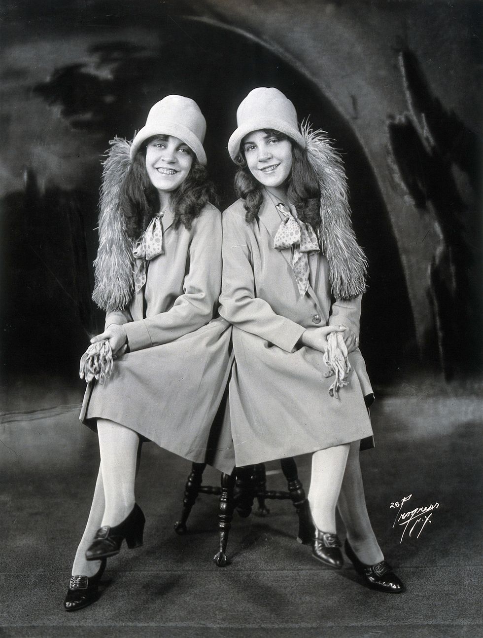Joined At The Hip: The Hilton Sisters