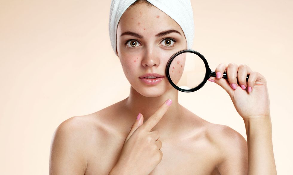 The Best Tips For Acne-Prone Skin
