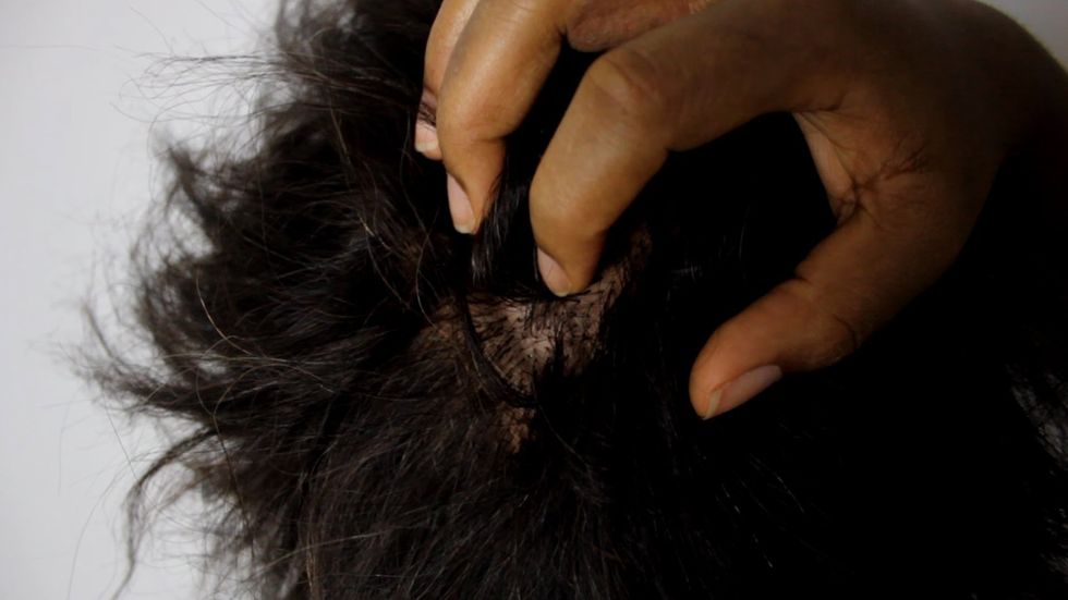 5 Tips For Taking Care Of A Flaky Scalp
