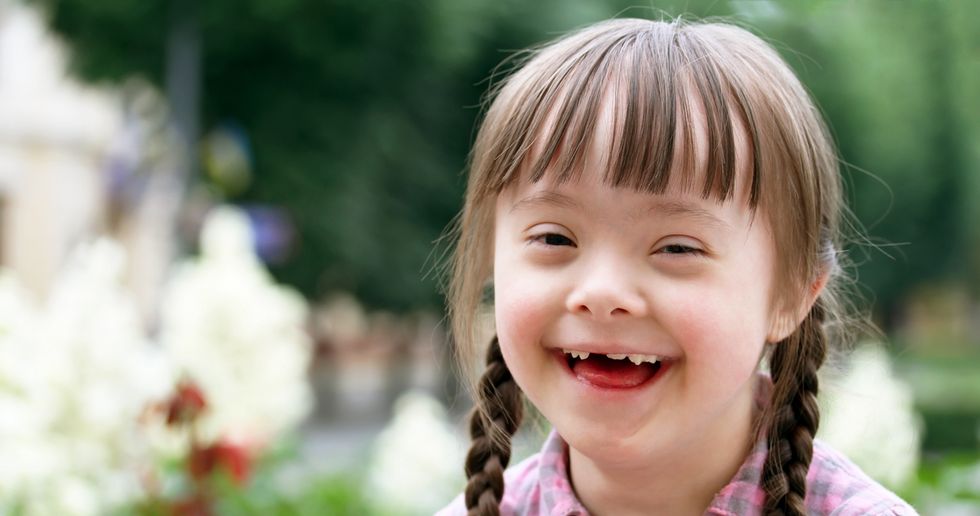 Why An Extra Chromosome Is An Extra Best Friend