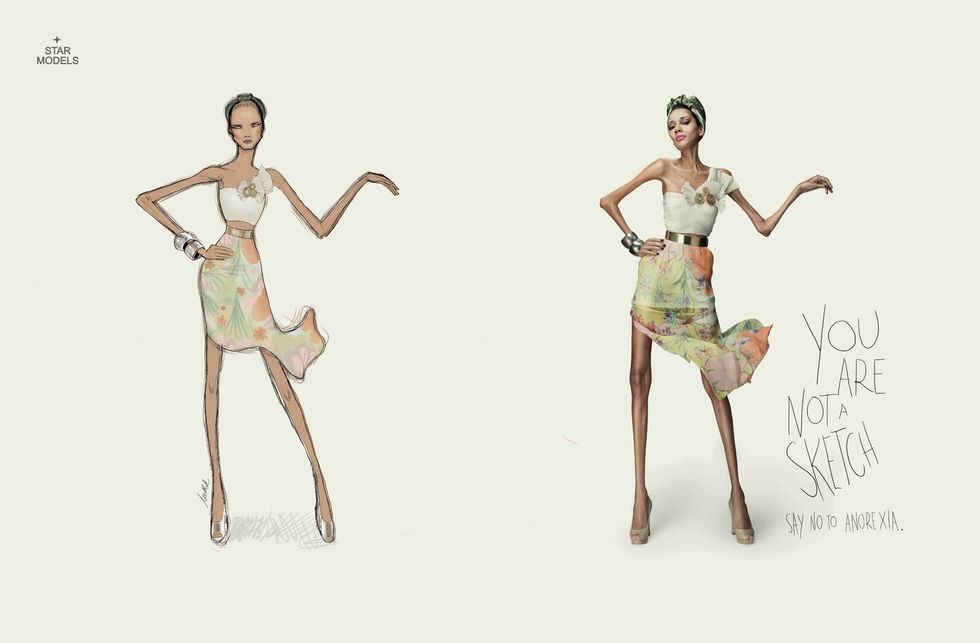 Eating Disorders Are NOT A Lifestyle Choice