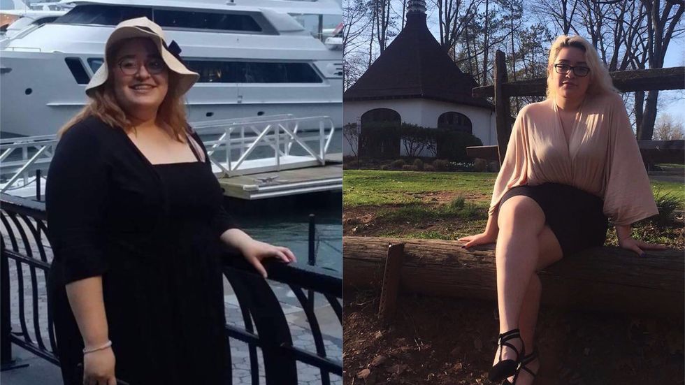 Being A Morbidly Obese Teenager And Living With What Comes After