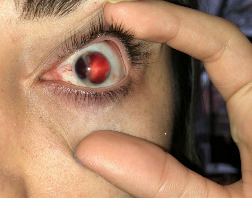 Understanding What It's Like Being Blind