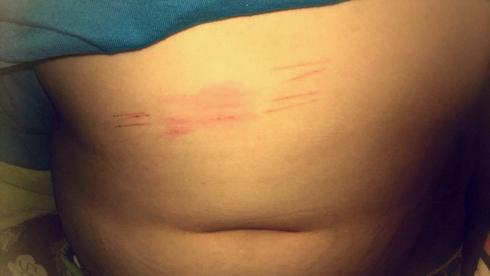 The Monster Within Me Is My Battle With Depression