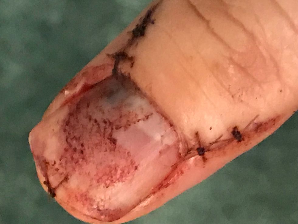 The Opioid Crisis Is Not My Fault I Am Just Someone Who Had An Issue With Acute Pain And Suffered