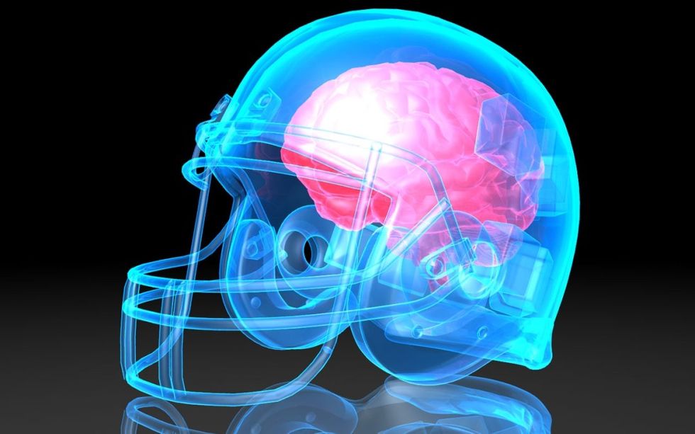 What You Didn't Know About Concussions