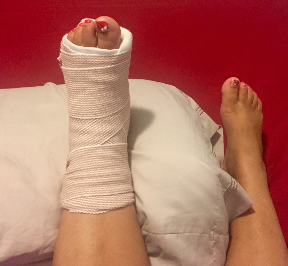 12 Things I Learned Getting Around With A Gimp Ankle, So You ~Hopefully~ Don't Have To
