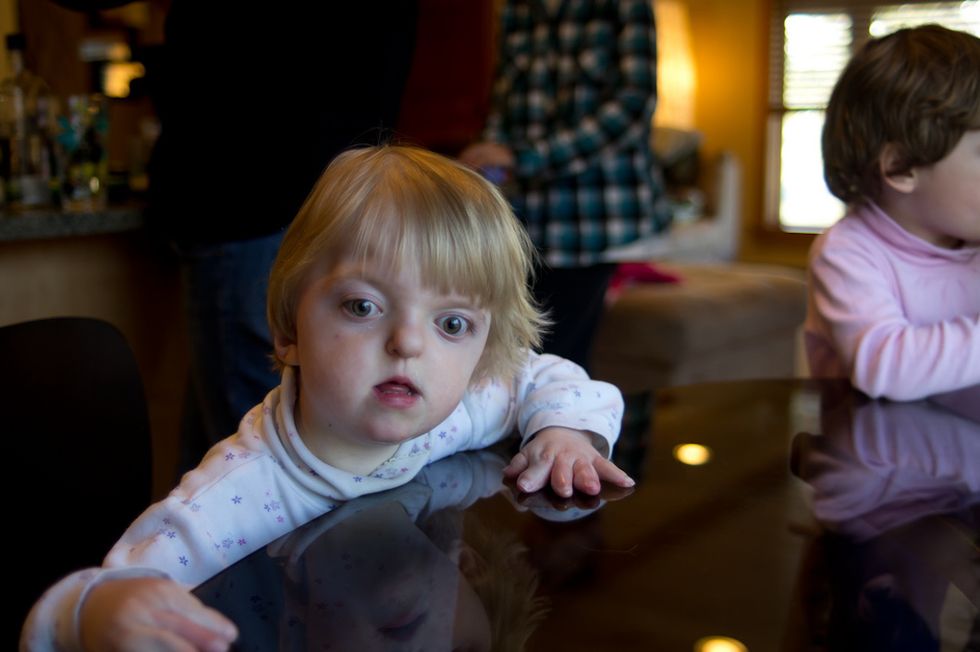 June Is Apert Syndrome Awareness Month