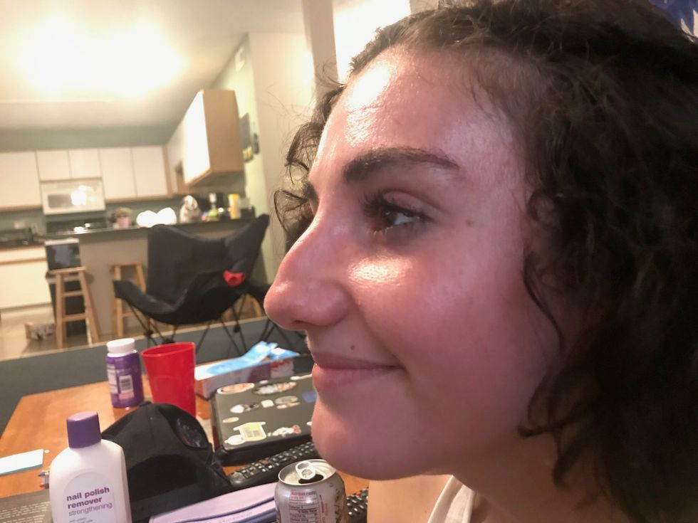 Unique Hump: Learning To Love My Nose