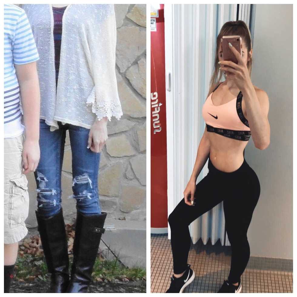 How I Survived My Eating Disorder