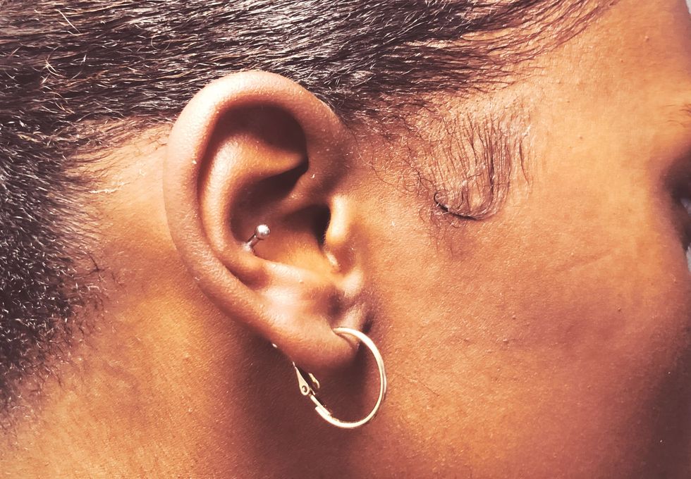 I’ve Had My Conch Pierced for Almost One Year and It's Still Not Healed