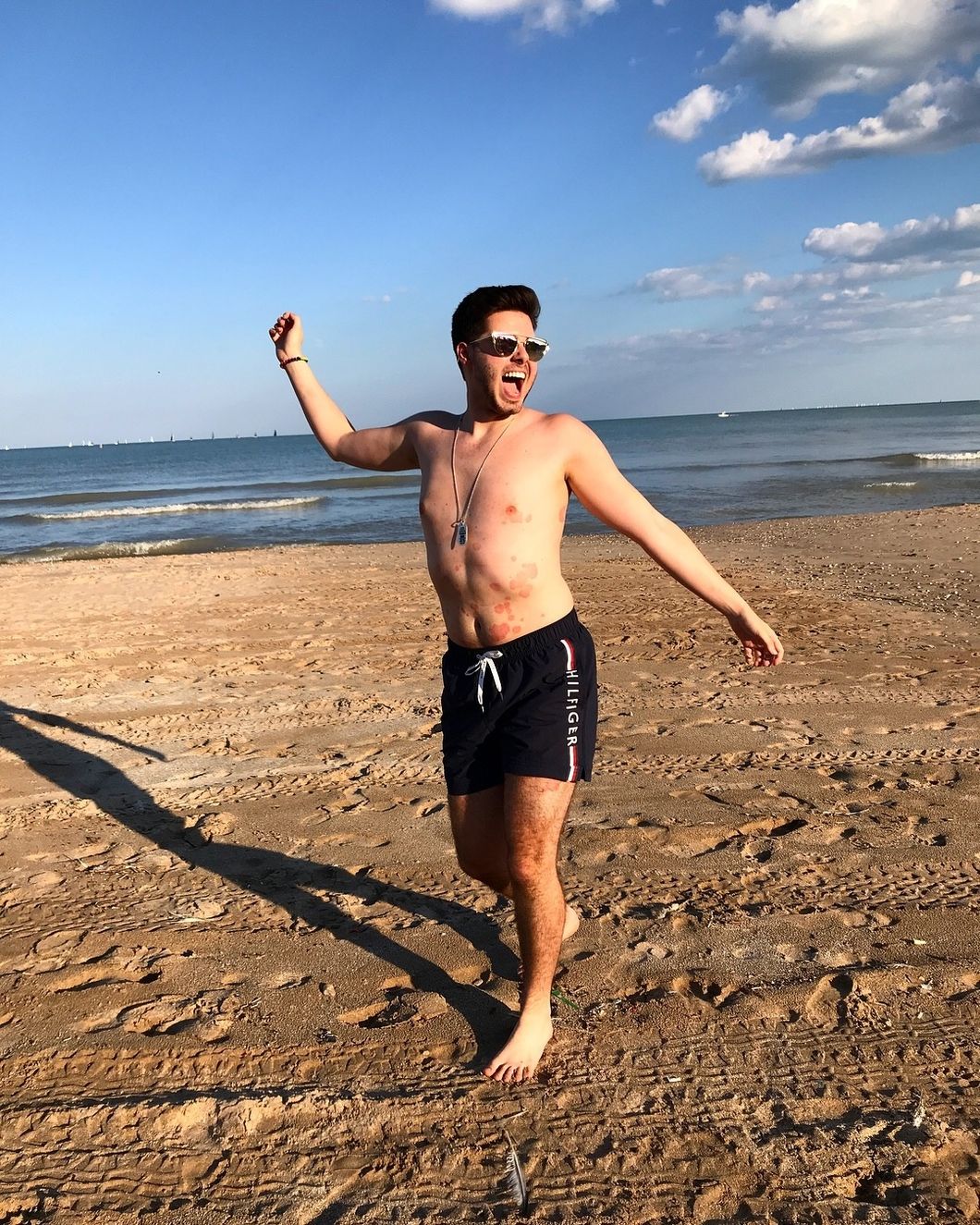 My Greatest Insecurity Was My Psoriasis But It Taught Me Not To Take What Everyone Thinks Of Me To Heart